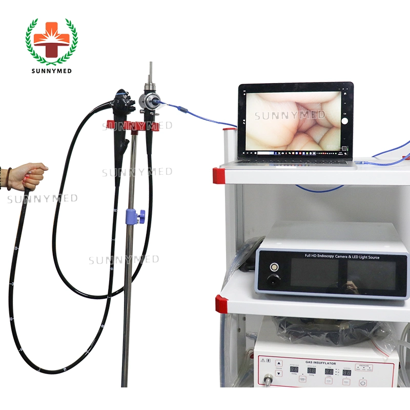 Flexible Gastroscope Smart Endoscopy System with LED Light Source